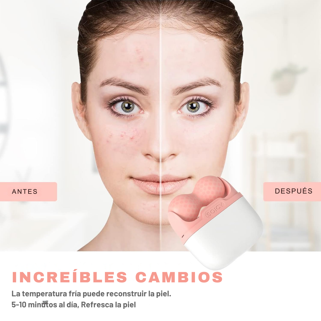 ICE ROLLER: COMPRA 1 CON 50% DE DESCUENTO