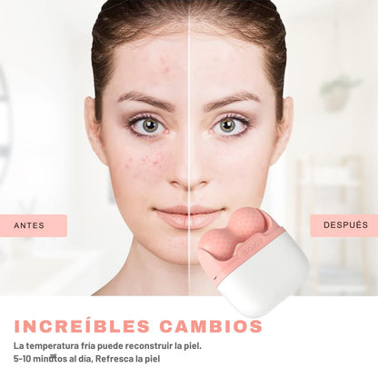 ICE ROLLER - TERAPIA DE HIELO